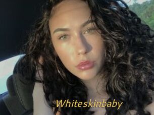 Whiteskinbaby