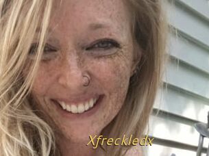 Xfreckledx